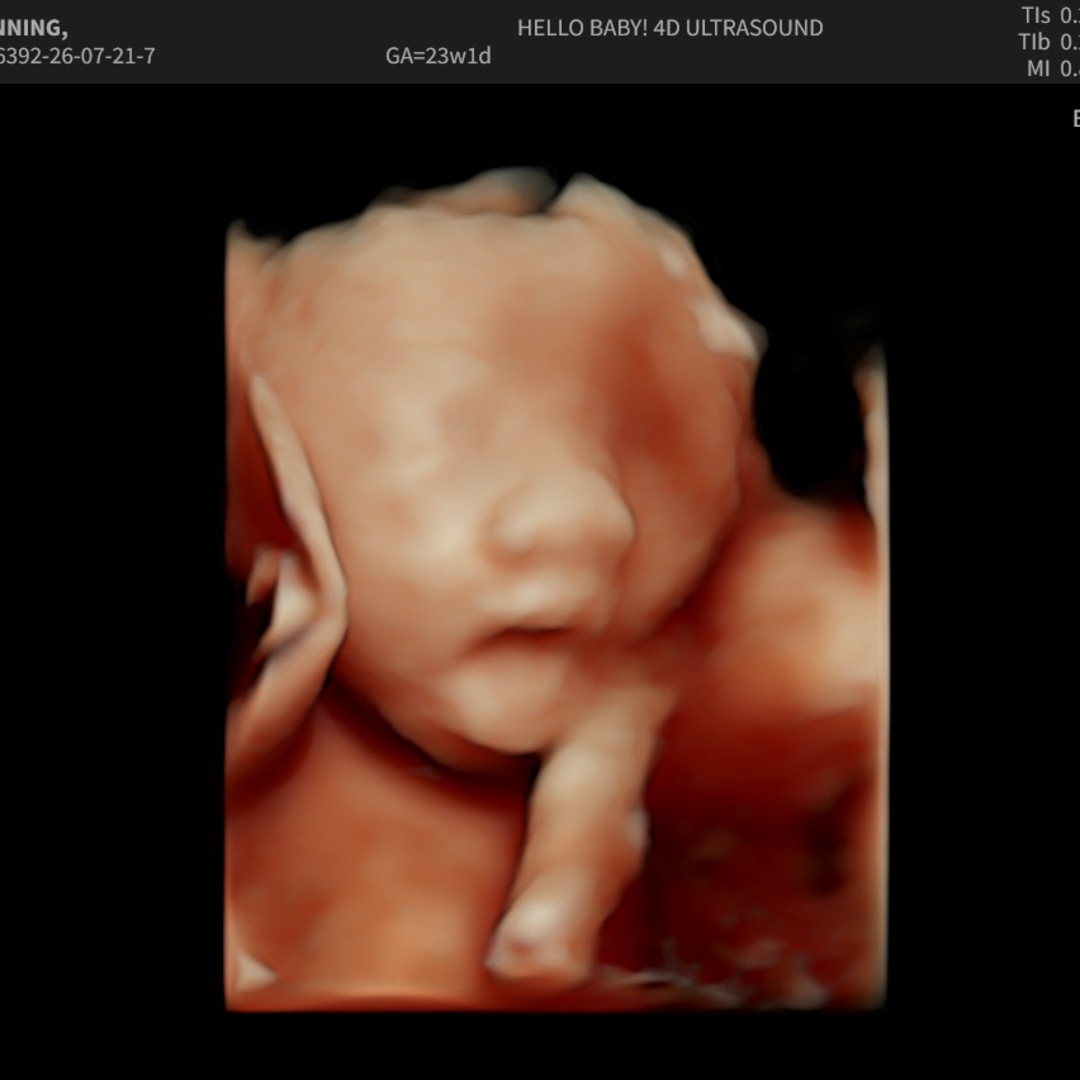 Photo shared by Alexis for their Babylist baby registry.