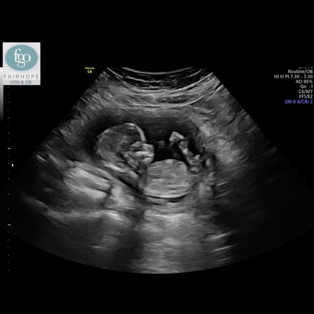 Photo shared by Lacey for their Babylist baby registry.