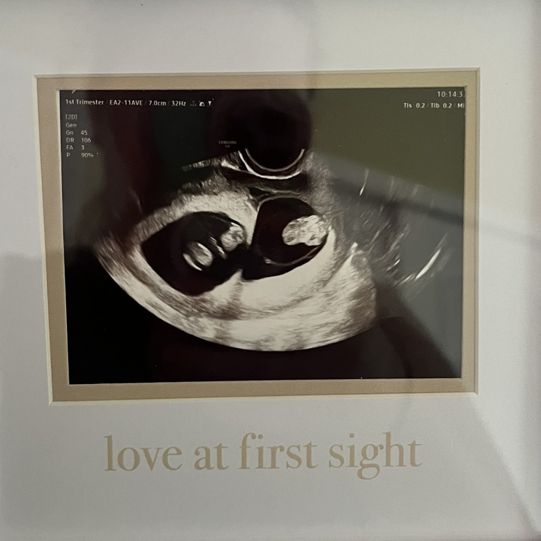 Photo shared by Angie for their Babylist baby registry.