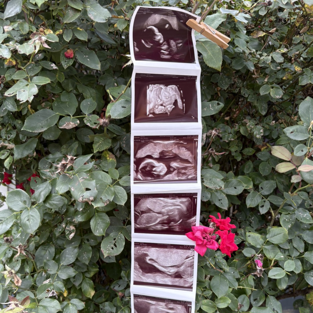 Photo shared by Taylor for their Babylist baby registry.