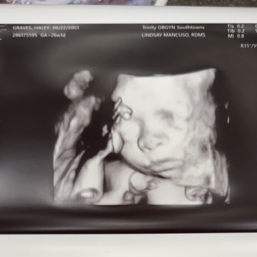 Photo shared by Haley for their Babylist baby registry.