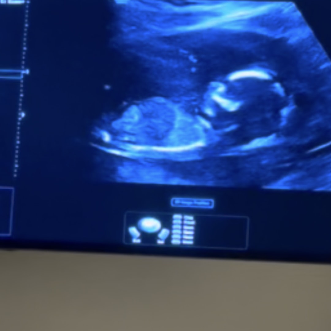 Photo shared by Paulina for their Babylist baby registry.