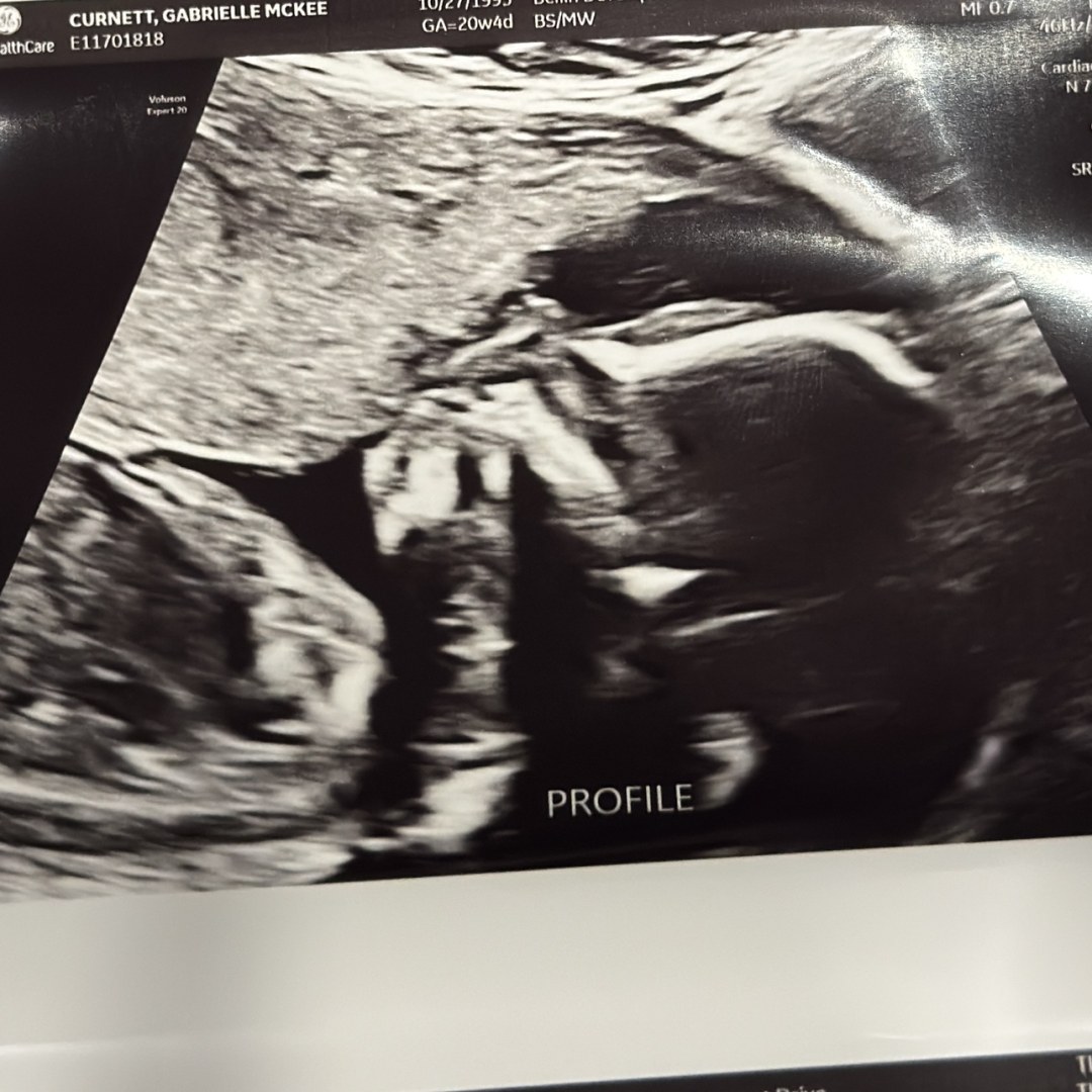 Photo shared by Gabrielle for their Babylist baby registry.