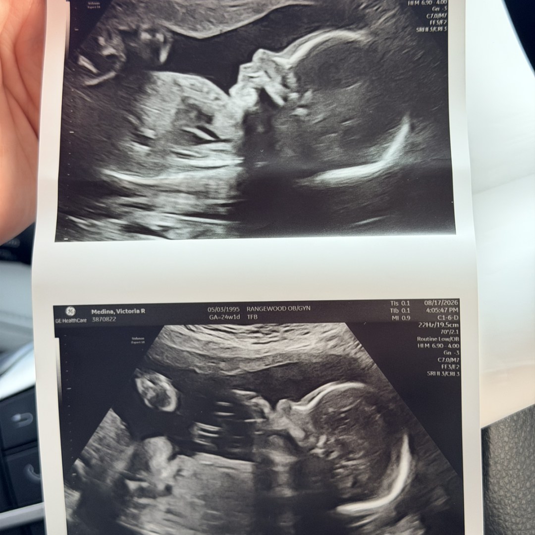 Photo shared by Victoria for their Babylist baby registry.