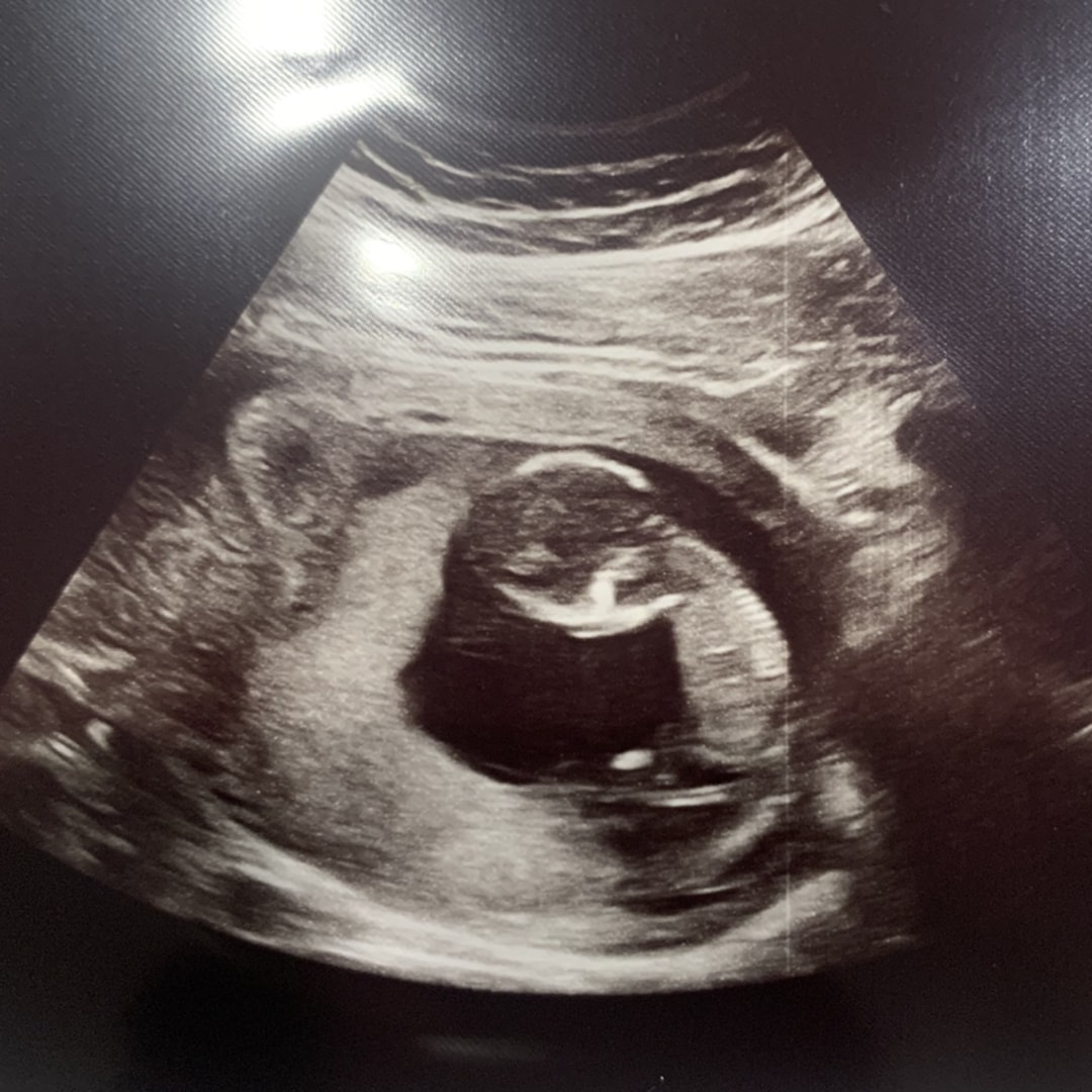 Photo shared by Christina for their Babylist baby registry.