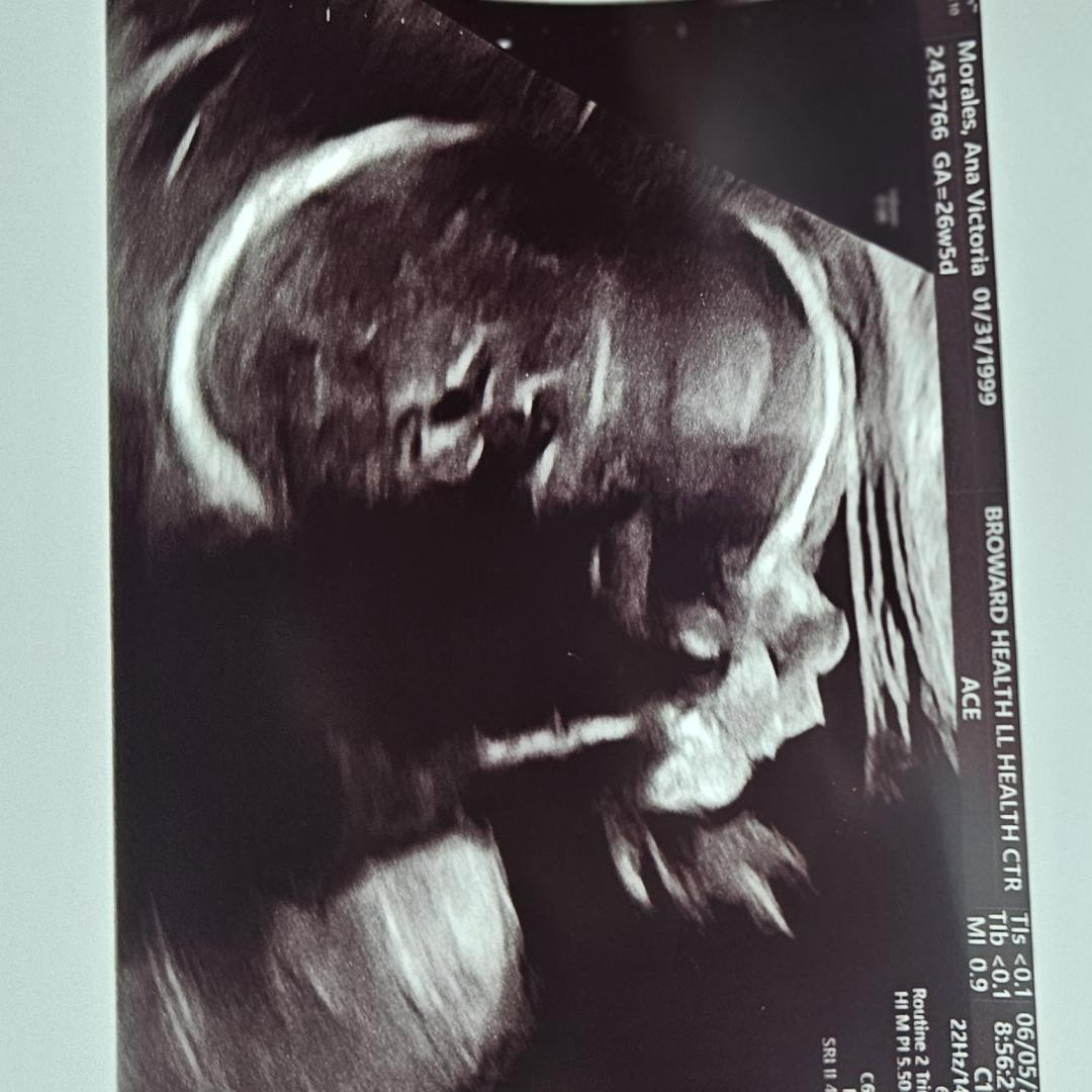 Photo shared by Ana-Victoria for their Babylist baby registry.