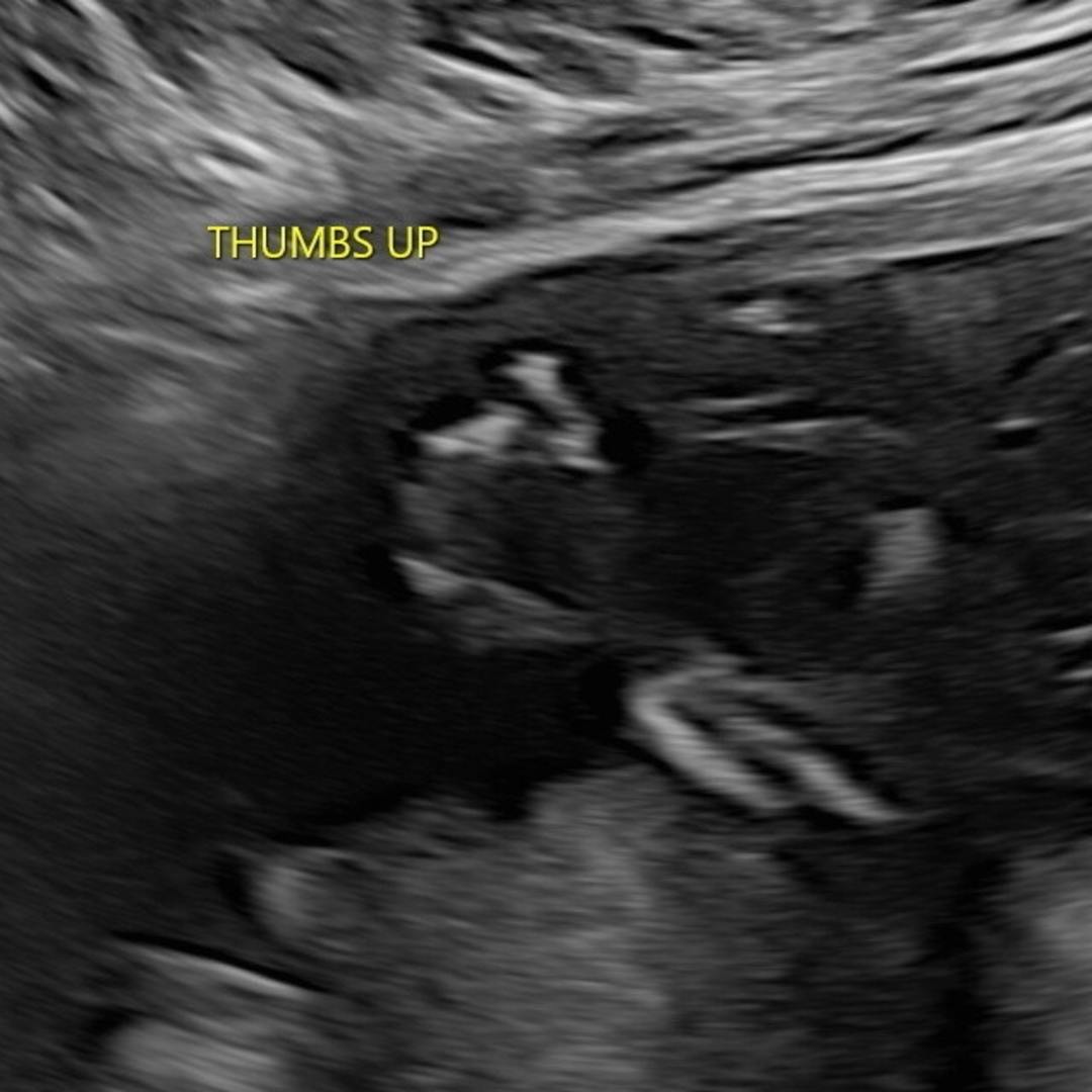 Photo shared by Emily for their Babylist baby registry.