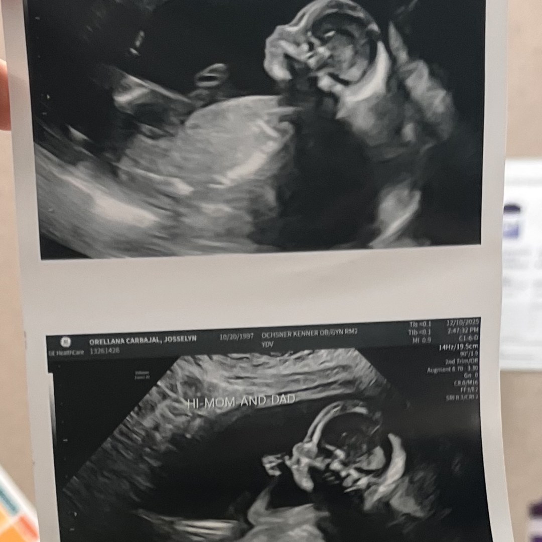 Photo shared by Josselyn for their Babylist baby registry.