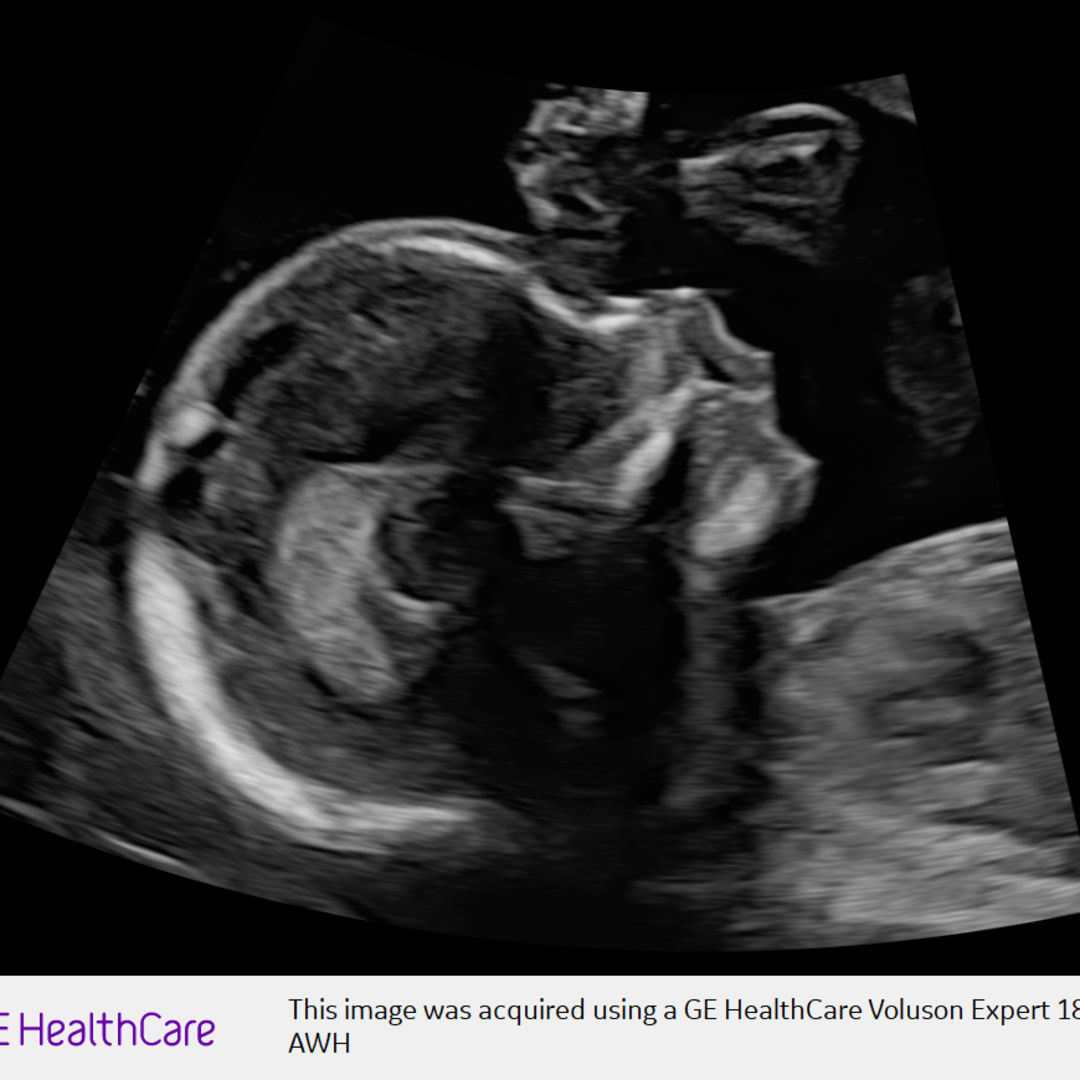 Photo shared by Madison for their Babylist baby registry.