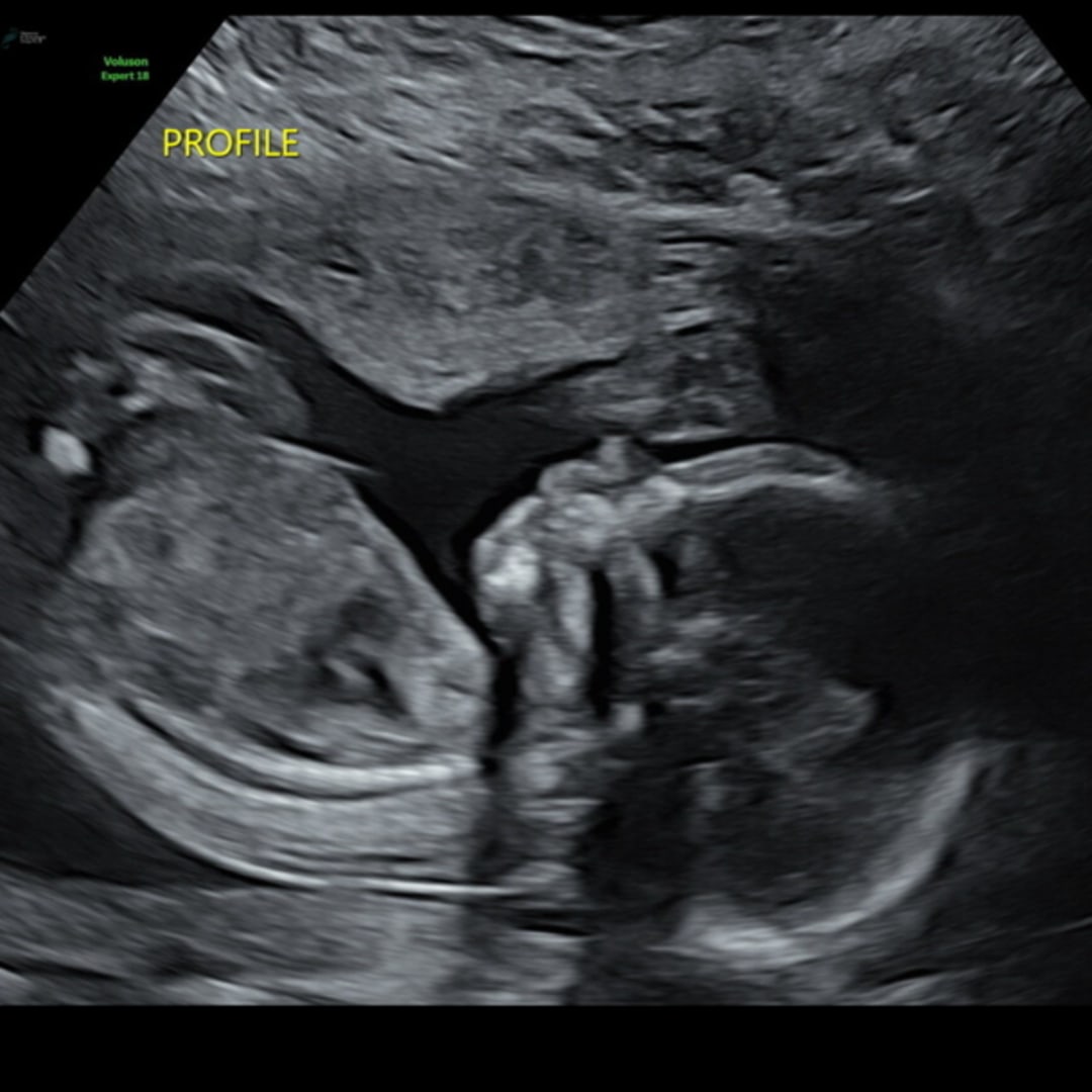 Photo shared by Ameyah for their Babylist baby registry.