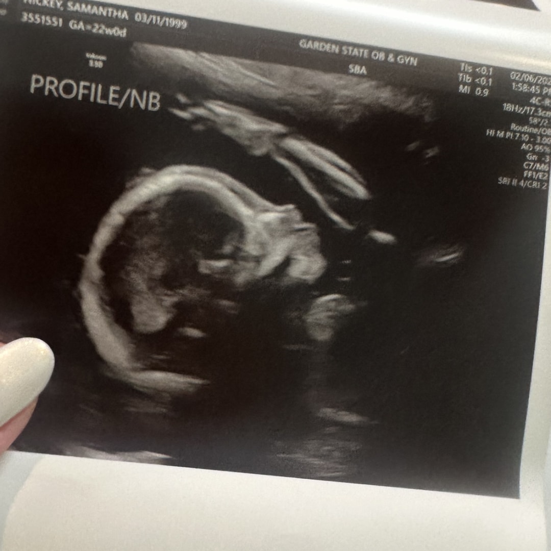 Photo shared by Samantha for their Babylist baby registry.