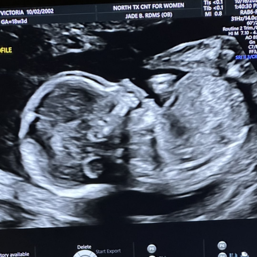 Photo shared by Tori for their Babylist baby registry.