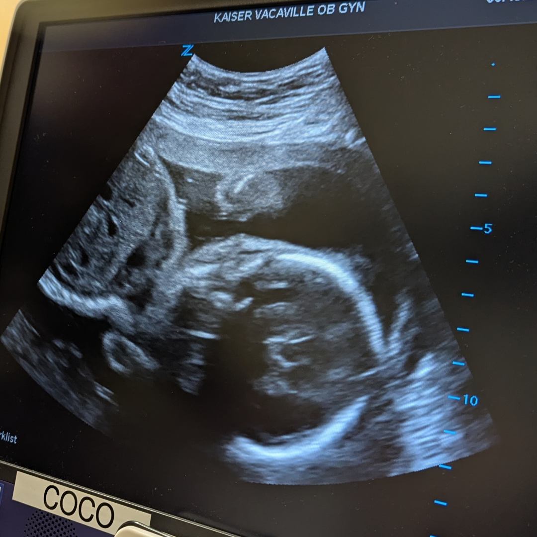 Photo shared by Clarrisa for their Babylist baby registry.