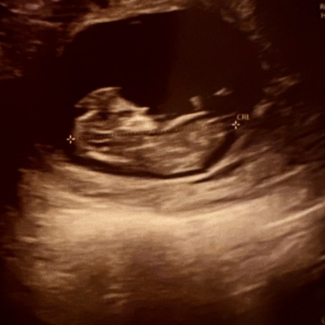 Photo shared by Natalia for their Babylist baby registry.