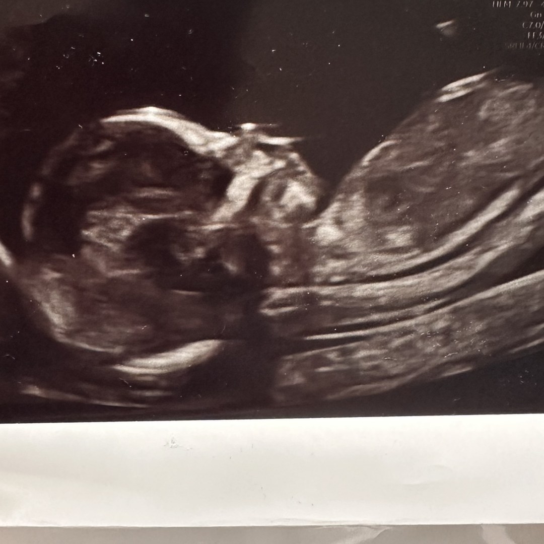 Photo shared by Abegail for their Babylist baby registry.