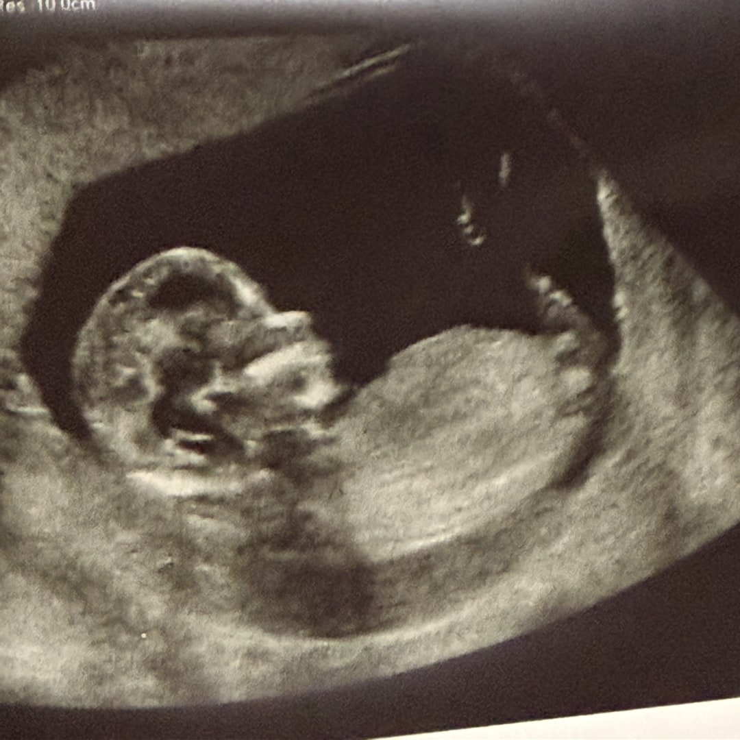 Photo shared by Jayleen for their Babylist baby registry.
