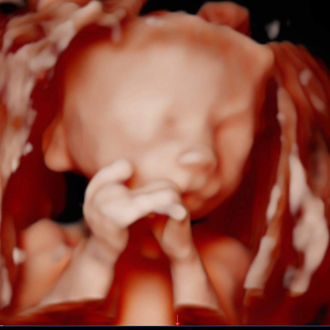 Photo shared by Mckenna for their Babylist baby registry.