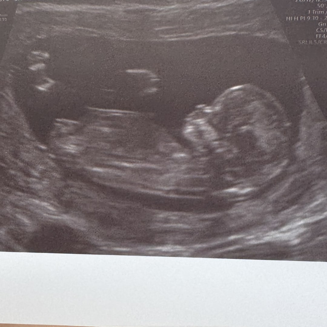 Photo shared by Madi for their Babylist baby registry.
