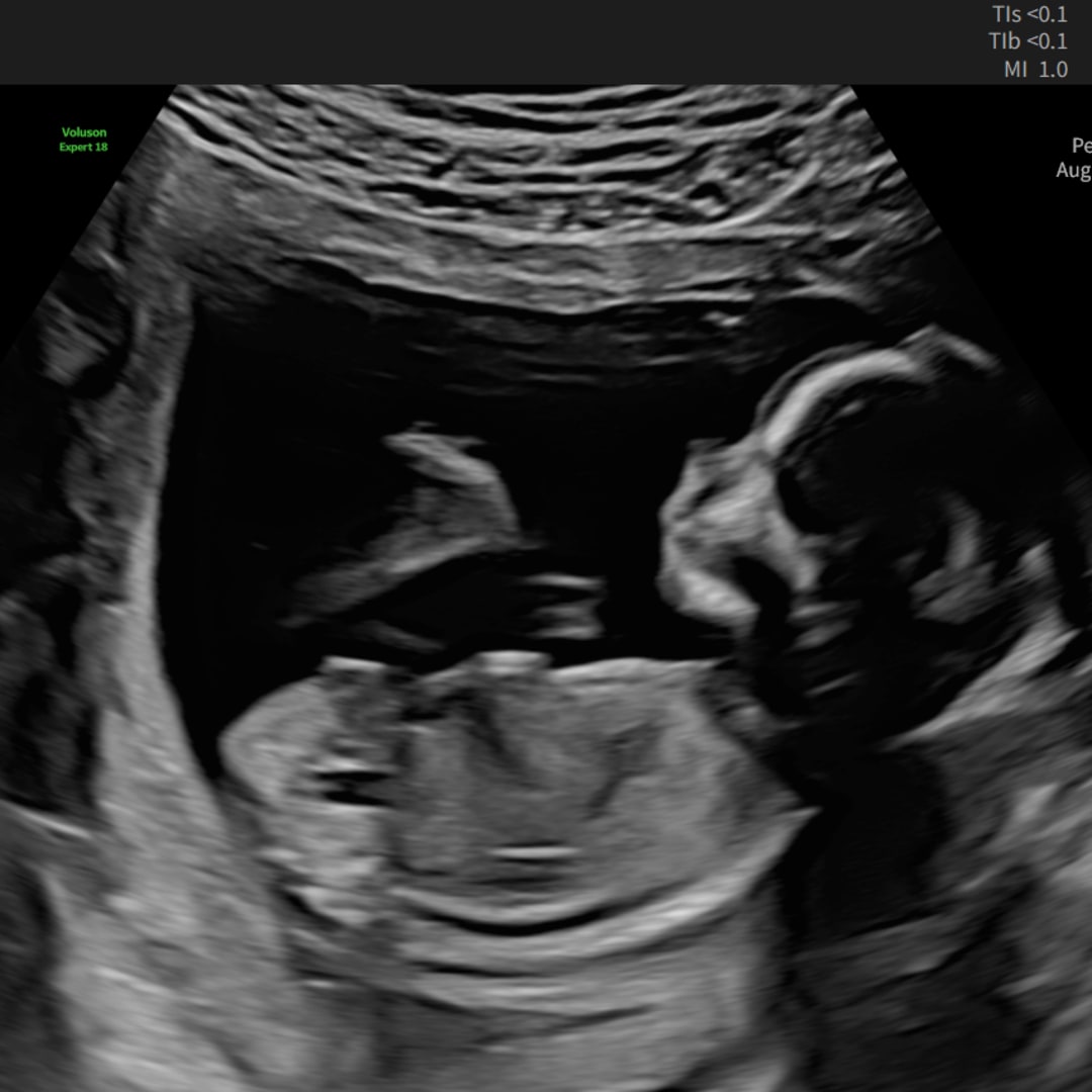 Photo shared by Cheyenne for their Babylist baby registry.