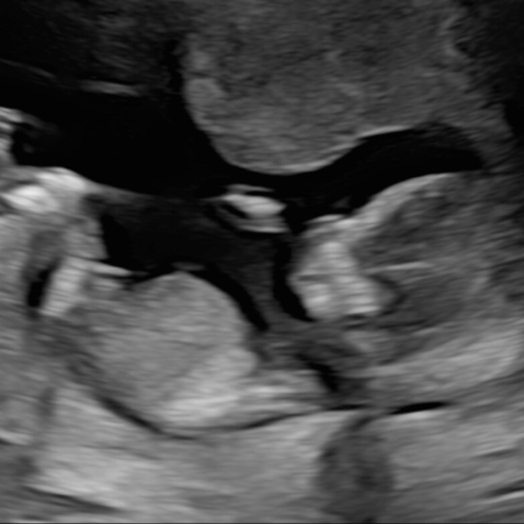 Photo shared by Rebekah for their Babylist baby registry.