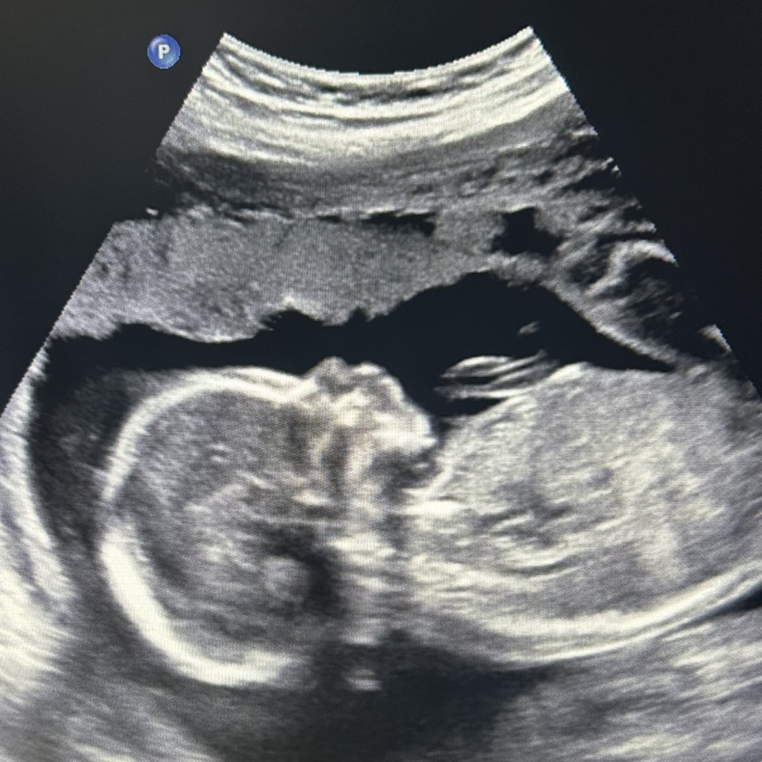 Photo shared by Hannah for their Babylist baby registry.