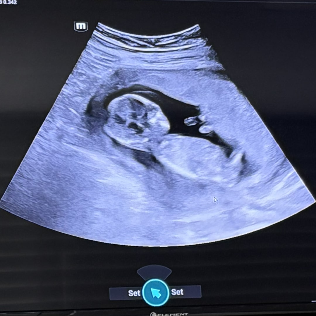 Photo shared by Gracie for their Babylist baby registry.