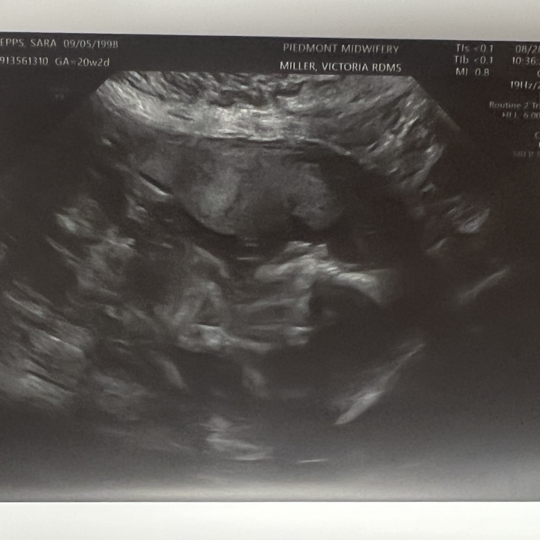 Photo shared by Sara for their Babylist baby registry.