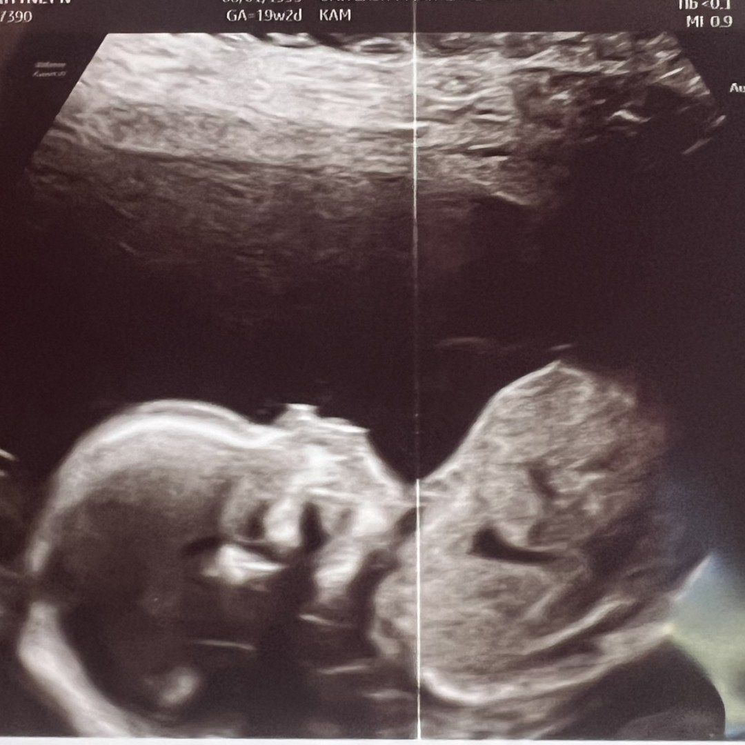 Photo shared by Brittney for their Babylist baby registry.