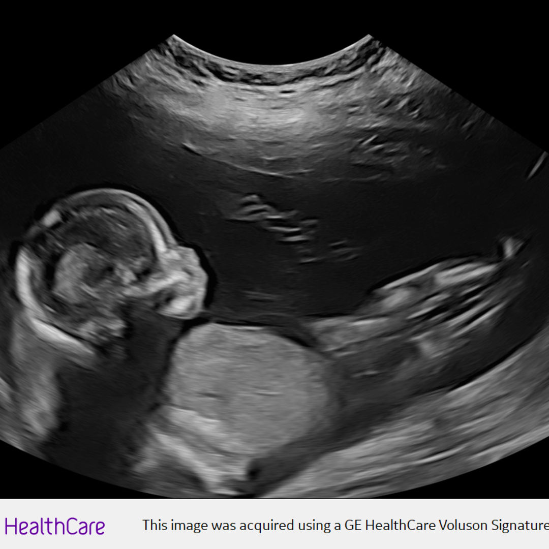 Photo shared by Samantha for their Babylist baby registry.