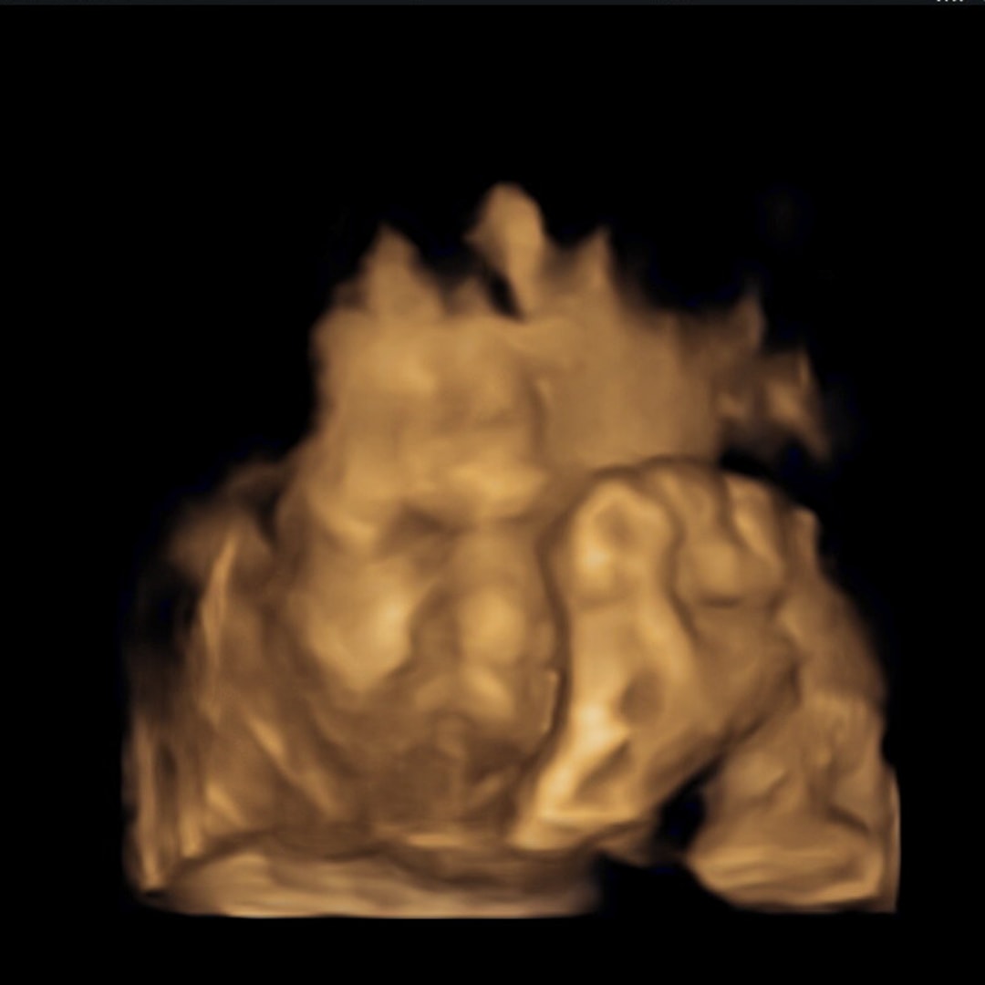 Photo shared by Ashleigh for their Babylist baby registry.