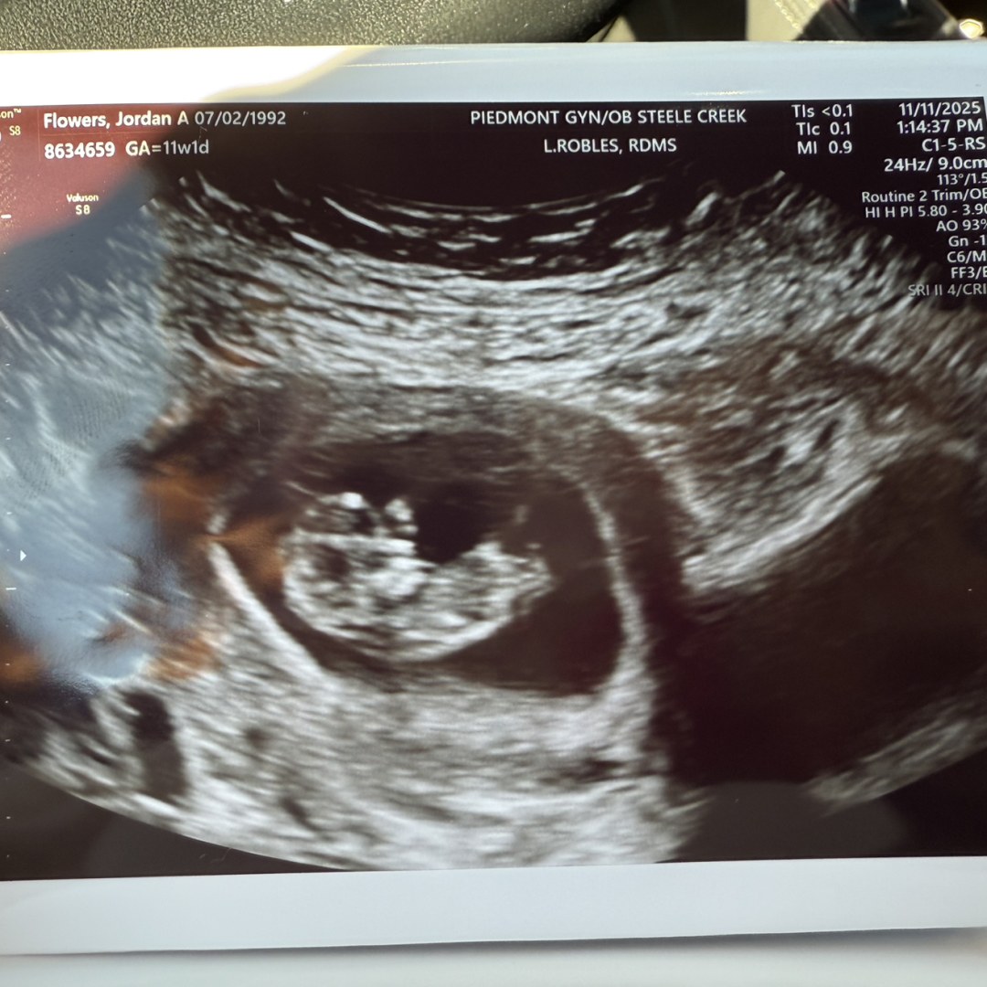 Photo shared by Jordan for their Babylist baby registry.