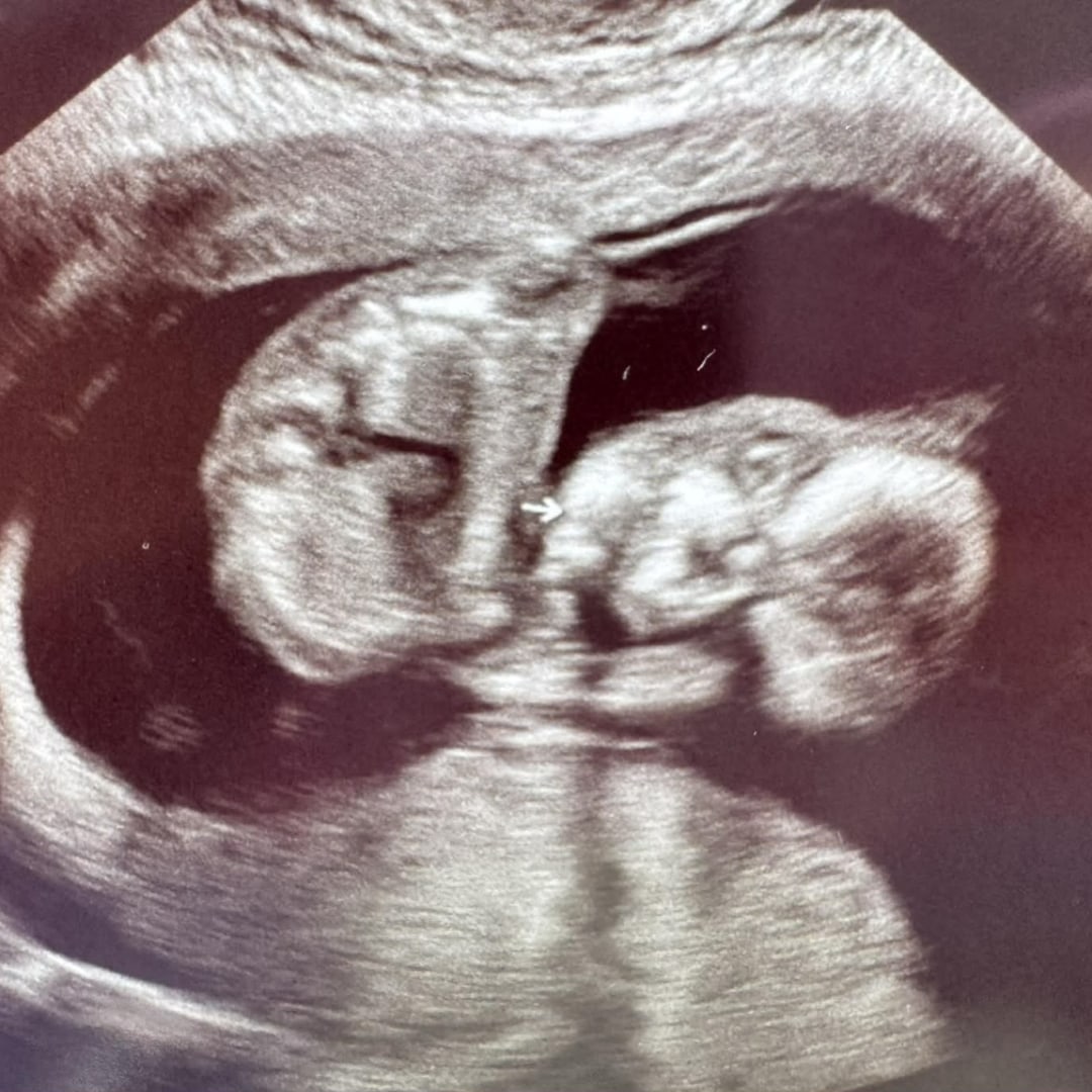 Photo shared by Madelynn for their Babylist baby registry.