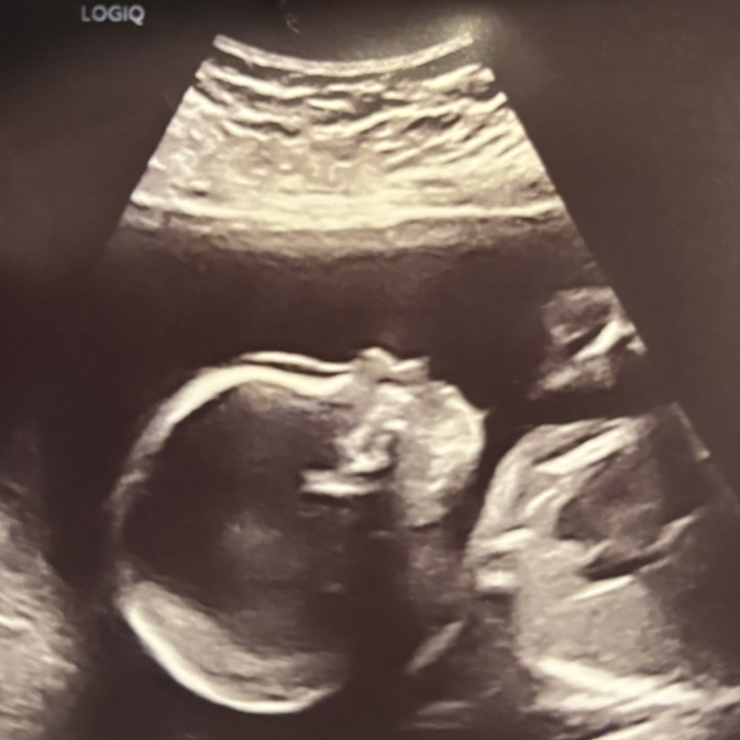 Photo shared by Isabela for their Babylist baby registry.