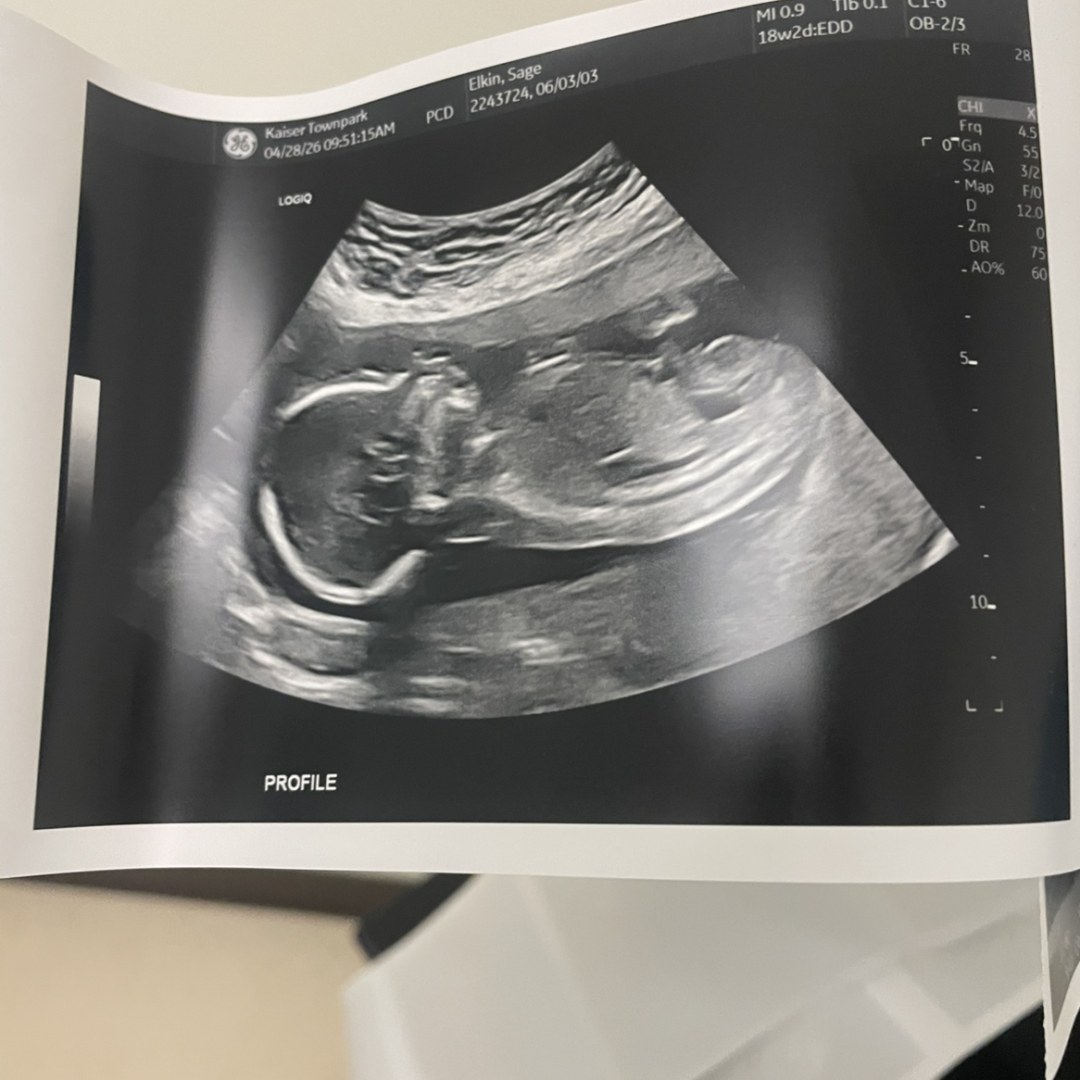 Photo shared by Sage for their Babylist baby registry.