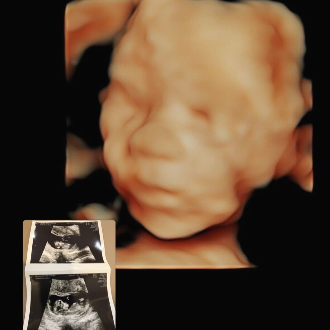 Photo shared by Emilee for their Babylist baby registry.