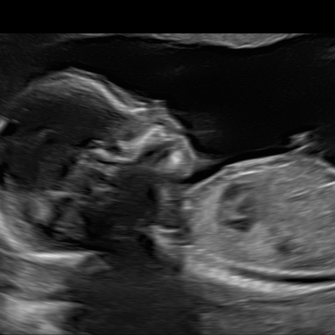 Photo shared by Shanerica for their Babylist baby registry.