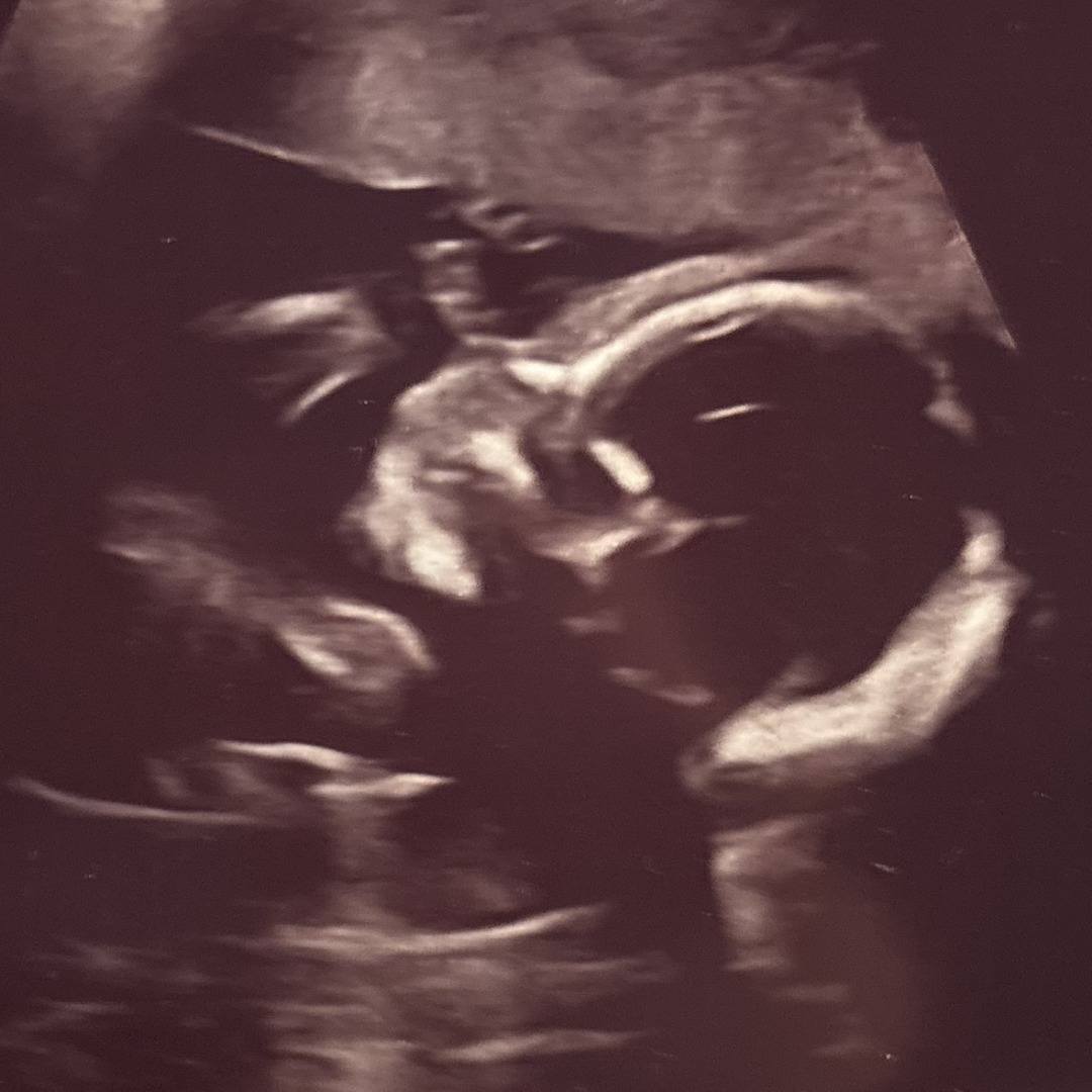 Photo shared by Haley for their Babylist baby registry.