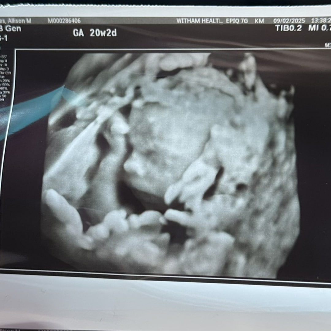 Photo shared by Allison for their Babylist baby registry.