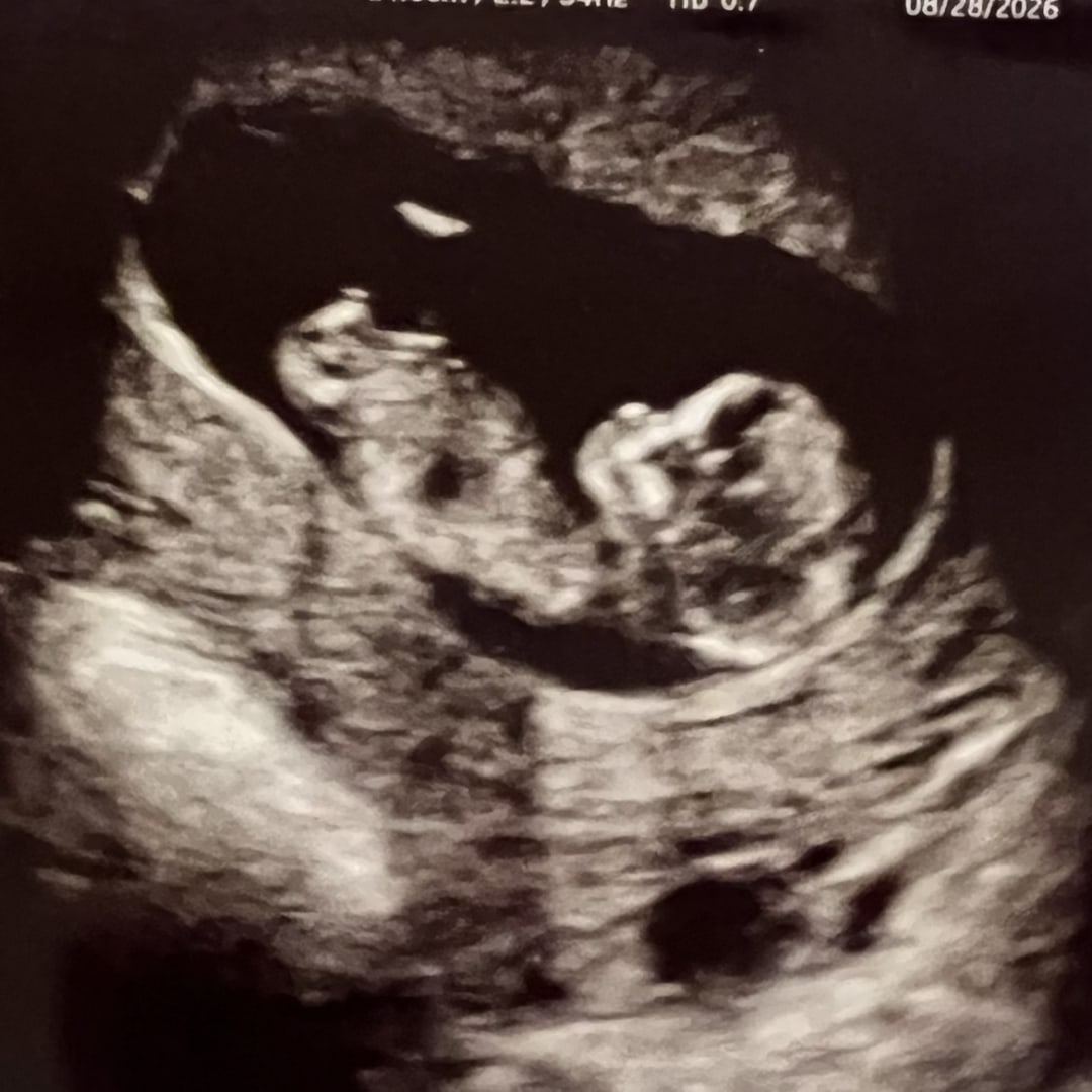 Photo shared by Hannah for their Babylist baby registry.