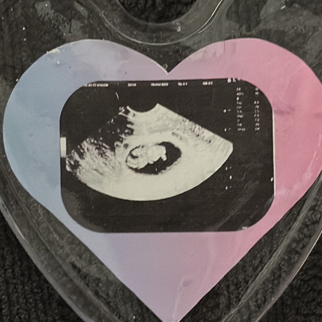 Photo shared by Chelsie for their Babylist baby registry.