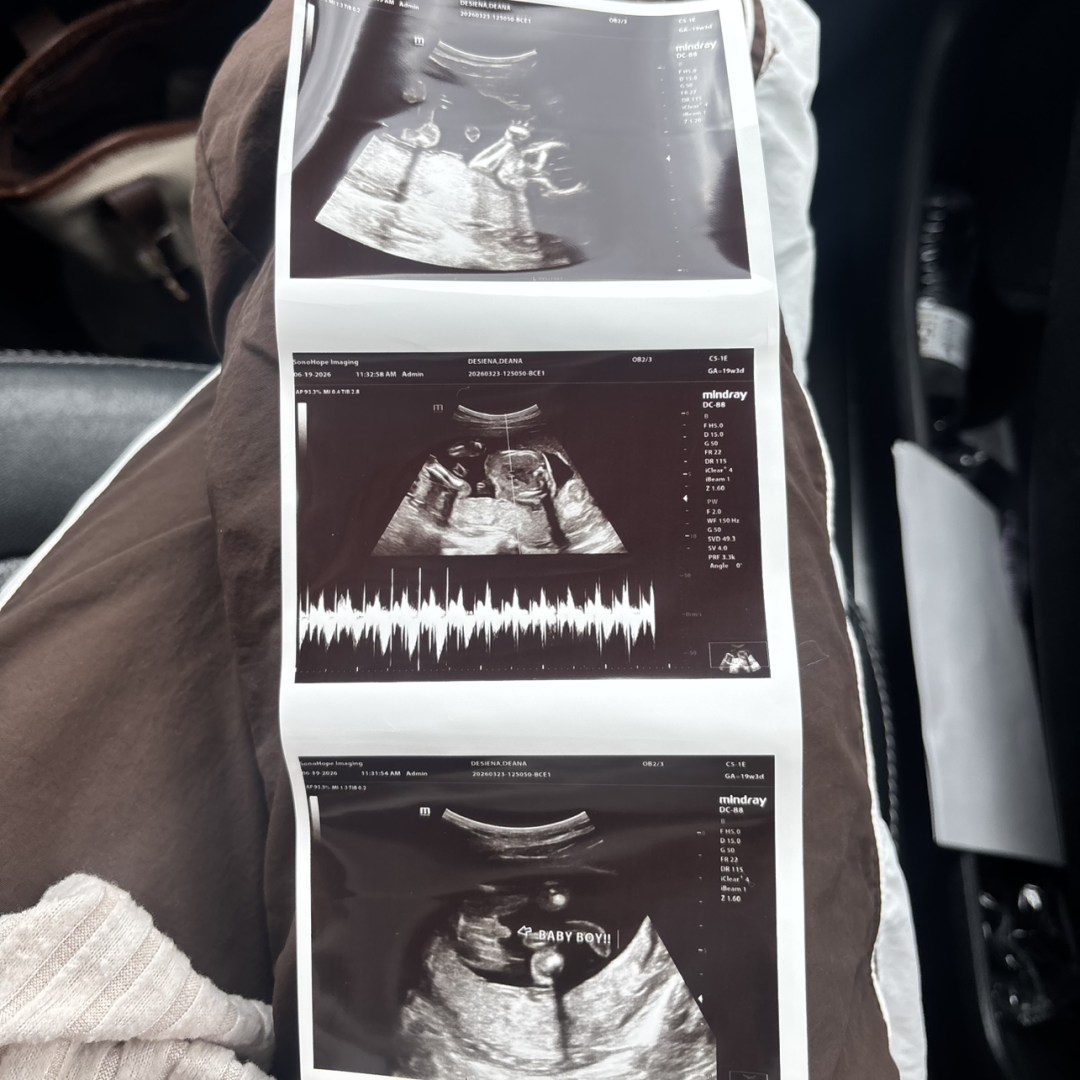 Photo shared by Deana for their Babylist baby registry.