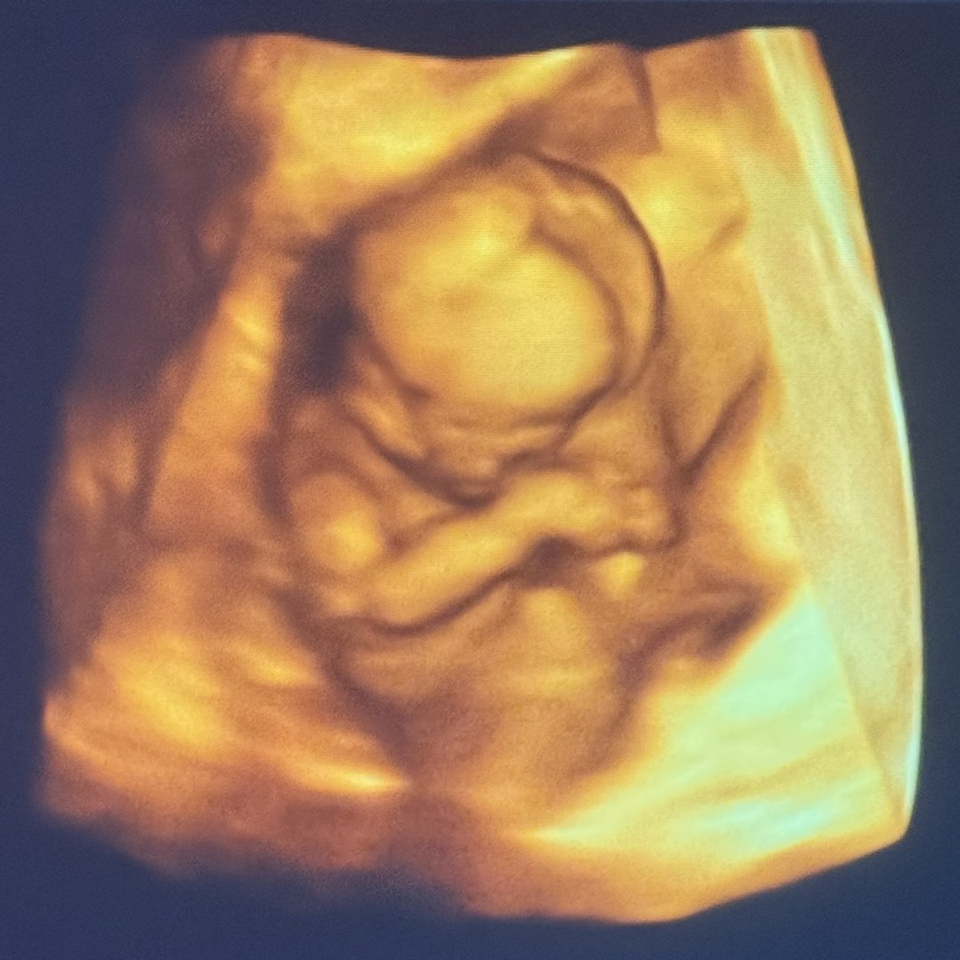 Photo shared by Colbie for their Babylist baby registry.