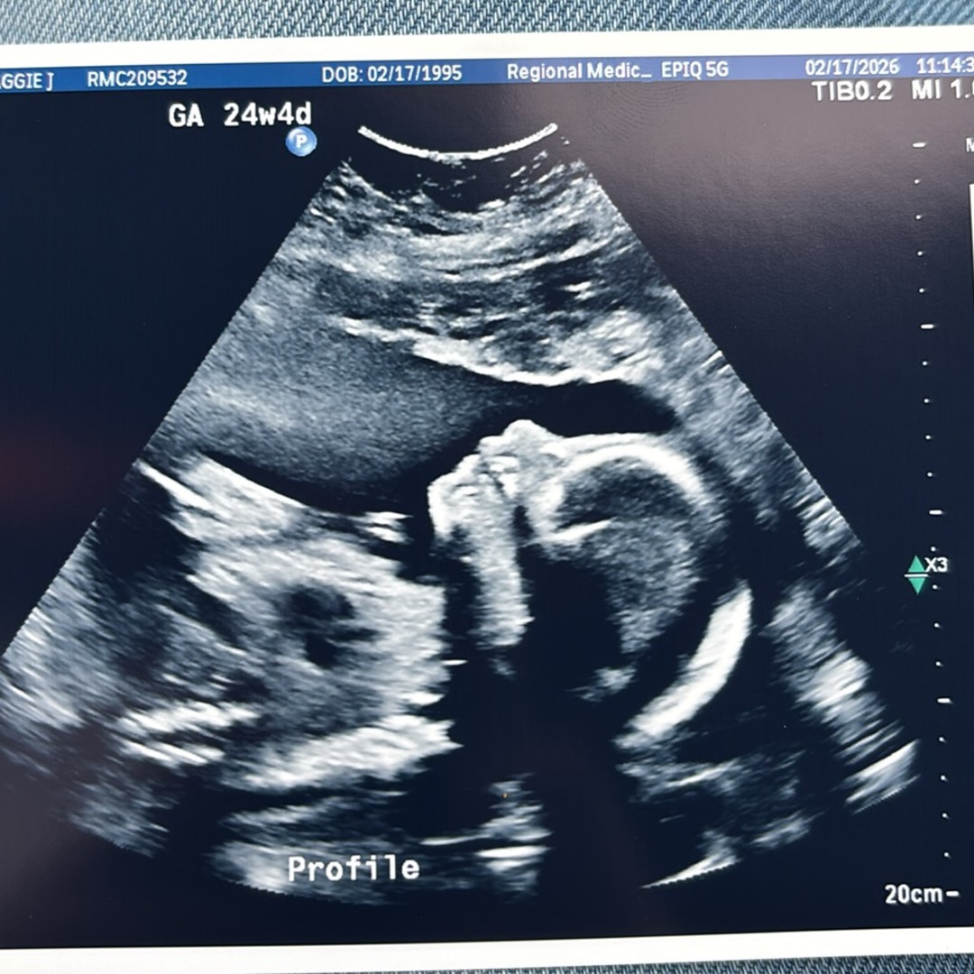 Photo shared by Maggie for their Babylist baby registry.