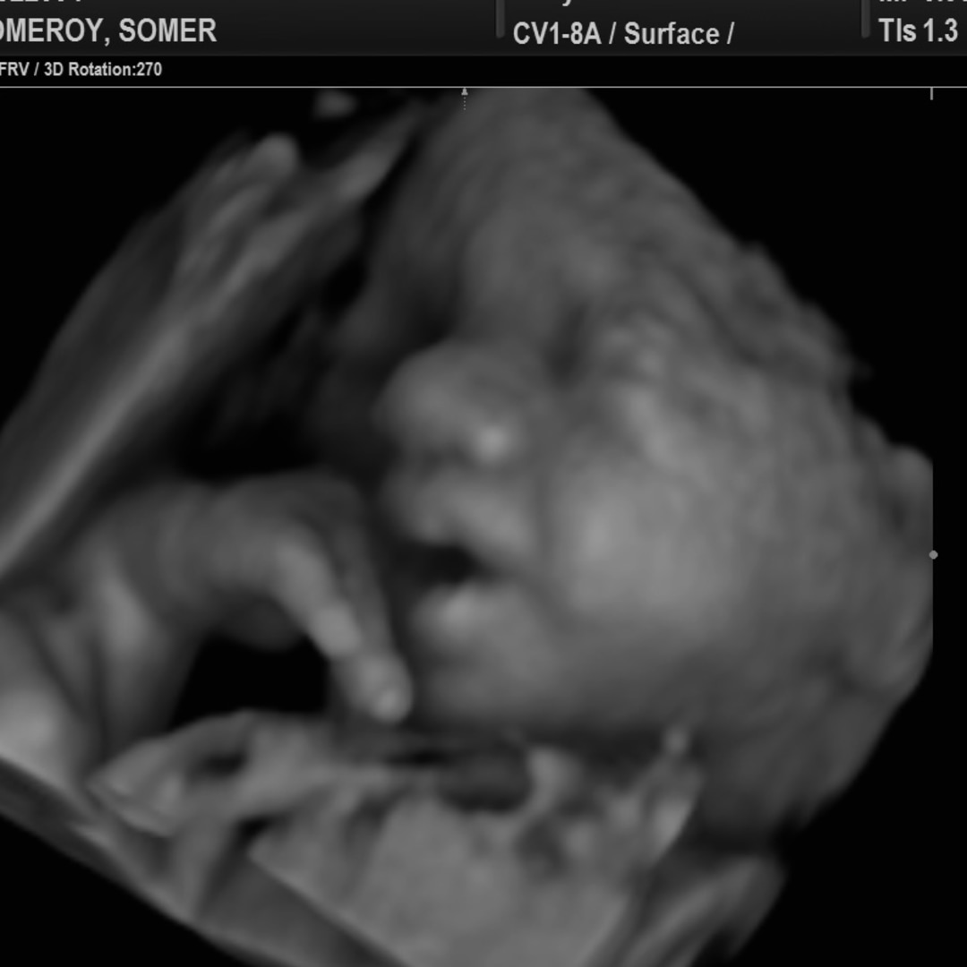 Photo shared by Somer for their Babylist baby registry.