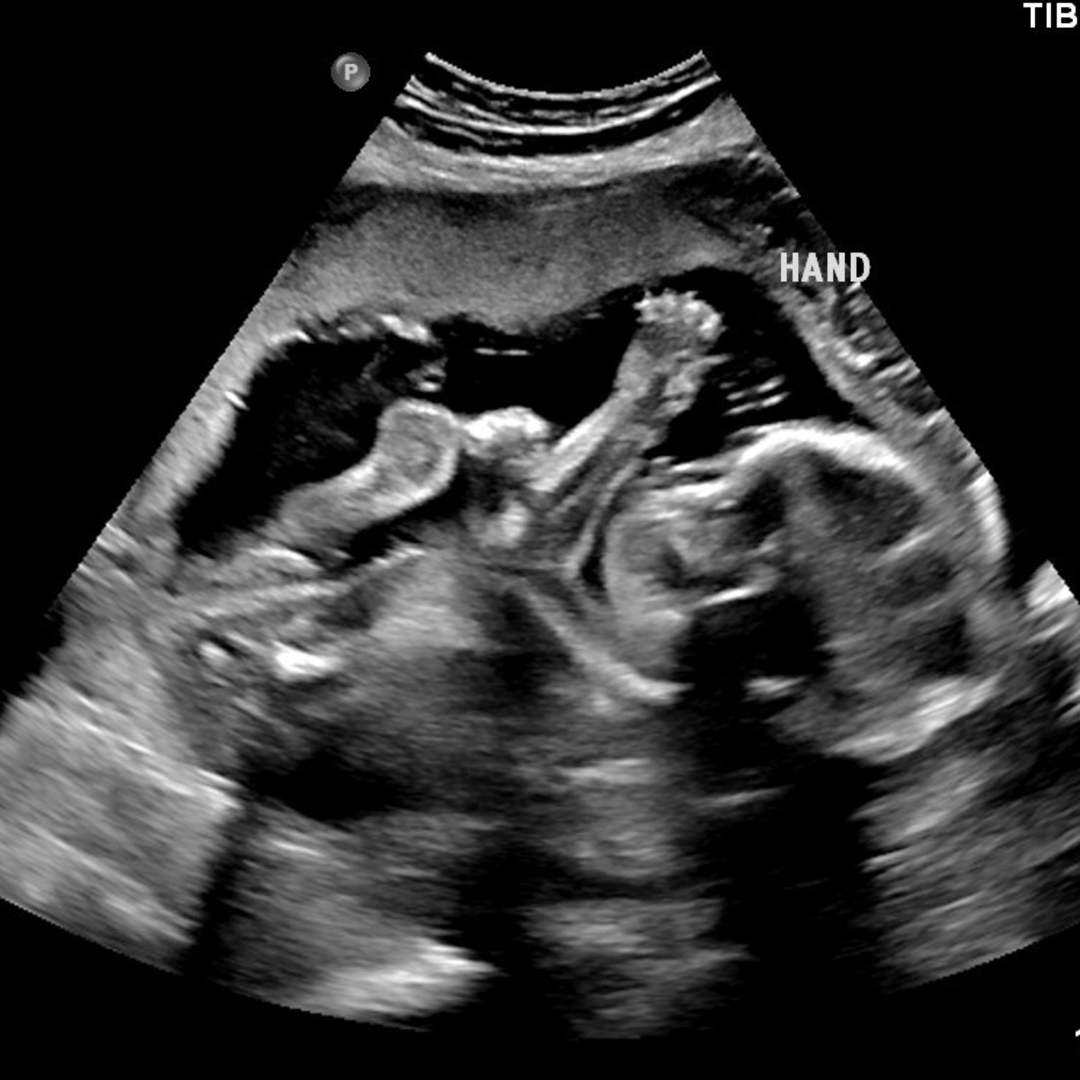 Photo shared by Hannah for their Babylist baby registry.