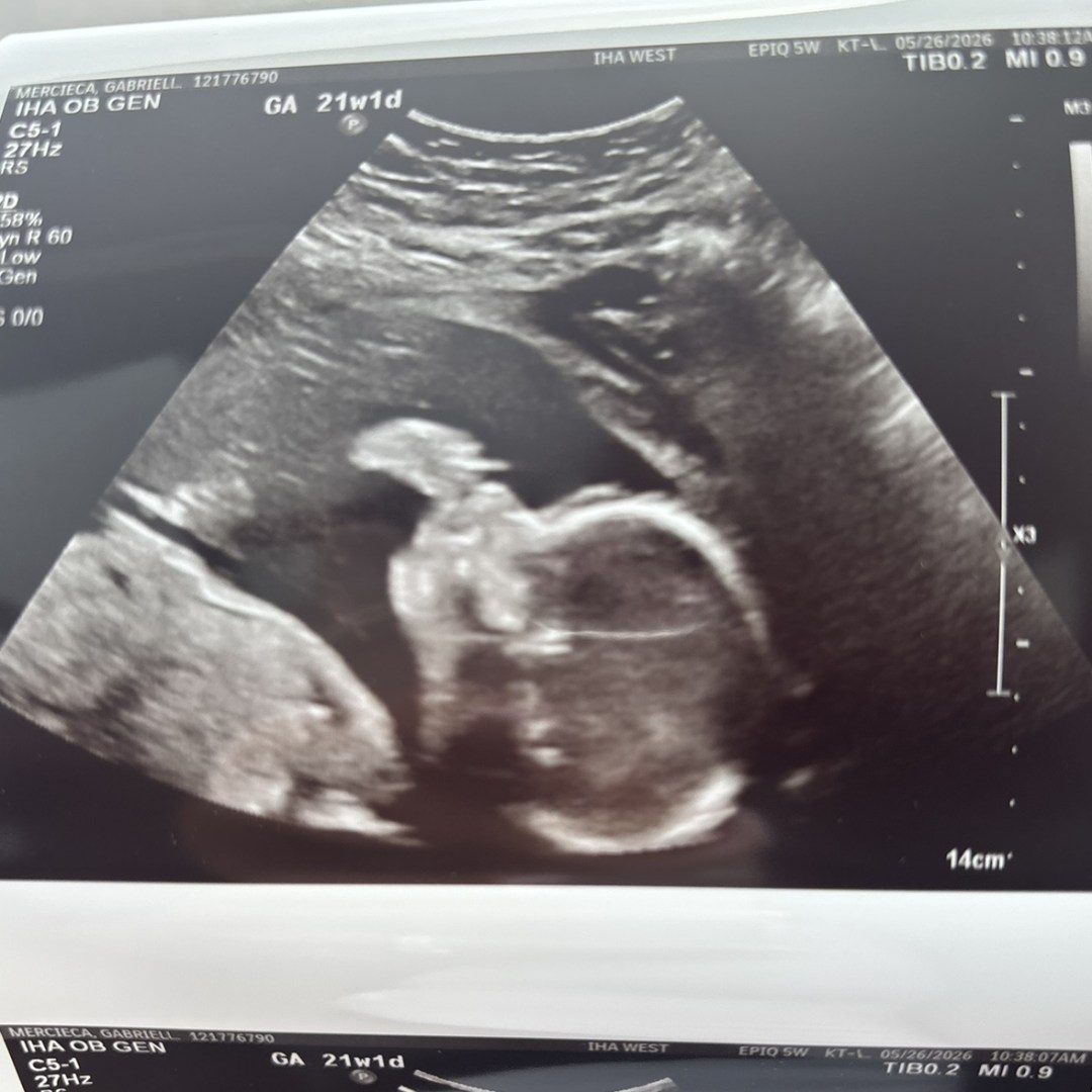Photo shared by Gabrielle for their Babylist baby registry.