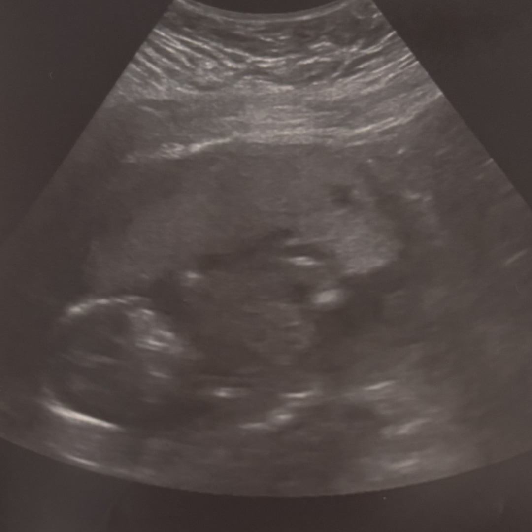 Photo shared by Brianne for their Babylist baby registry.