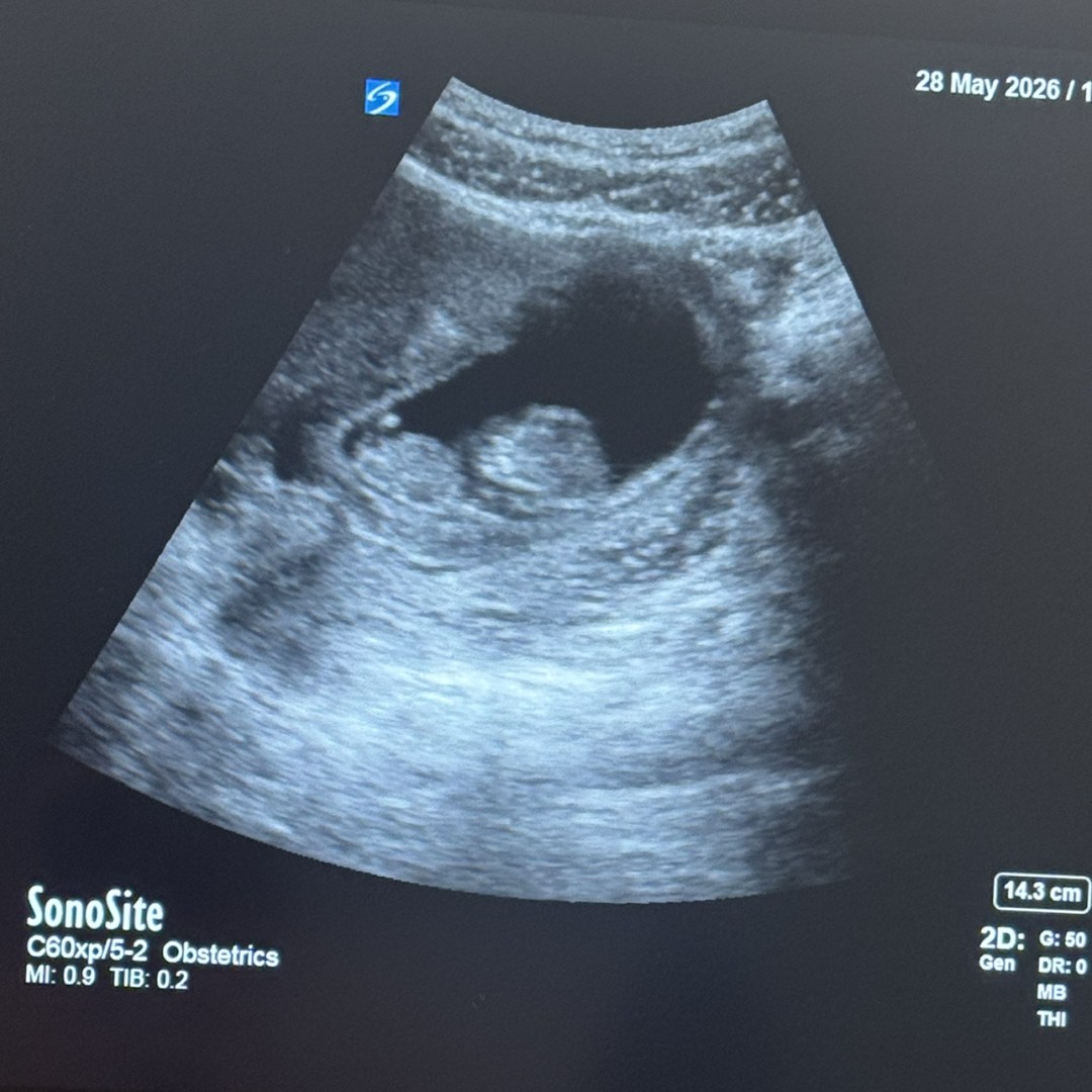 Photo shared by Aubry for their Babylist baby registry.