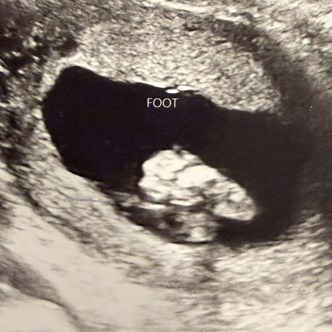Photo shared by Imani for their Babylist baby registry.