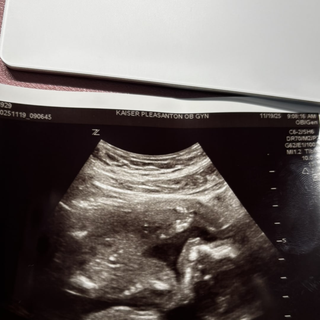 Photo shared by Margarita for their Babylist baby registry.